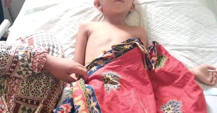 Ega Rambutnya Terlepas Akibat Tersangkut, Kondisinya Sudah Membaik