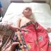 Ega Rambutnya Terlepas Akibat Tersangkut, Kondisinya Sudah Membaik