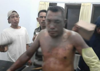 Istri Tega Siram Suami dengan Minyak Goreng Panas, Gara Gara Ini