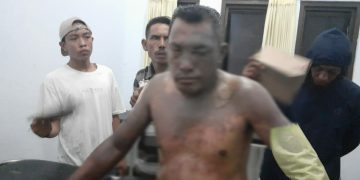 Istri Tega Siram Suami dengan Minyak Goreng Panas, Gara Gara Ini